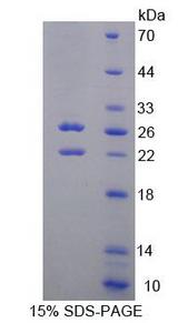 SPHK2 Protein - Recombinant Sphingosine Kinase 2 (SPHK2) by SDS-PAGE