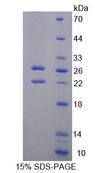 SPHK2 Protein - Recombinant Sphingosine Kinase 2 (SPHK2) by SDS-PAGE