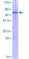 SPIB Protein - 12.5% SDS-PAGE of human SPIB stained with Coomassie Blue