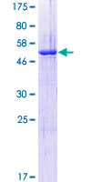 SPIN / SPIN1 Protein - 12.5% SDS-PAGE of human SPIN1 stained with Coomassie Blue