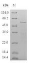 SPIN / SPIN1 Protein - (Tris-Glycine gel) Discontinuous SDS-PAGE (reduced) with 5% enrichment gel and 15% separation gel.