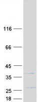 SPIN / SPIN1 Protein - Purified recombinant protein SPIN1 was analyzed by SDS-PAGE gel and Coomassie Blue Staining