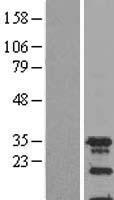SPIN2A Protein - Western validation with an anti-DDK antibody * L: Control HEK293 lysate R: Over-expression lysate