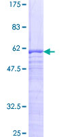 SPIN2A Protein - 12.5% SDS-PAGE of human SPIN2 stained with Coomassie Blue