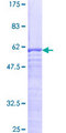 SPIN2A Protein - 12.5% SDS-PAGE of human SPIN2 stained with Coomassie Blue