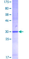 SPINK1 Protein - 12.5% SDS-PAGE of human SPINK1 stained with Coomassie Blue
