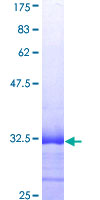 SPINK1 Protein - 12.5% SDS-PAGE Stained with Coomassie Blue.