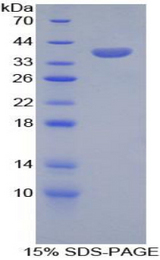 SPINK1 Protein - Recombinant Serine Peptidase Inhibitor Kazal Type 1 By SDS-PAGE
