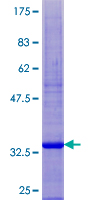 SPINK14 Protein - 12.5% SDS-PAGE of human SPINK5L2 stained with Coomassie Blue