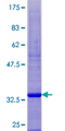 SPINK14 Protein - 12.5% SDS-PAGE of human SPINK5L2 stained with Coomassie Blue