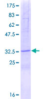 SPINK2 Protein - 12.5% SDS-PAGE of human SPINK2 stained with Coomassie Blue
