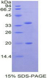 SPINK5 / LEKTI Protein - Recombinant Serine Peptidase Inhibitor Kazal Type 5 By SDS-PAGE