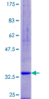 SPINK6 Protein - 12.5% SDS-PAGE of human SPINK6 stained with Coomassie Blue
