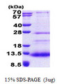 SPINK7 / ECRG2 Protein