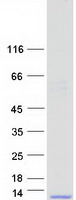 SPINK7 / ECRG2 Protein - Purified recombinant protein SPINK7 was analyzed by SDS-PAGE gel and Coomassie Blue Staining
