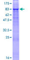 SPINT1 / HAI-1 Protein - 12.5% SDS-PAGE of human SPINT1 stained with Coomassie Blue