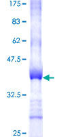 SPINT1 / HAI-1 Protein - 12.5% SDS-PAGE Stained with Coomassie Blue.