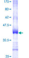 SPINT1 / HAI-1 Protein - 12.5% SDS-PAGE Stained with Coomassie Blue.