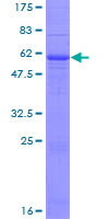 SPINT2 / HAI-2 Protein - 12.5% SDS-PAGE of human SPINT2 stained with Coomassie Blue