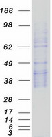 SPINT2 / HAI-2 Protein - Purified recombinant protein SPINT2 was analyzed by SDS-PAGE gel and Coomassie Blue Staining