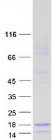 SPINT4 Protein - Purified recombinant protein SPINT4 was analyzed by SDS-PAGE gel and Coomassie Blue Staining