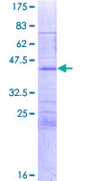 SPIRE1 Protein - 12.5% SDS-PAGE of human SPIRE1 stained with Coomassie Blue