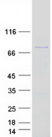SPIRE1 Protein - Purified recombinant protein SPIRE1 was analyzed by SDS-PAGE gel and Coomassie Blue Staining