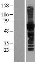 SPN / CD43 Protein - Western validation with an anti-DDK antibody * L: Control HEK293 lysate R: Over-expression lysate