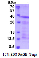 SPN / CD43 Protein