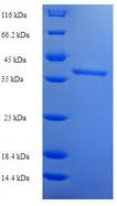 SPN / CD43 Protein