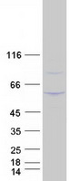 SPN / CD43 Protein - Purified recombinant protein SPN was analyzed by SDS-PAGE gel and Coomassie Blue Staining