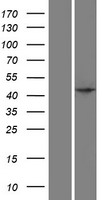 SPO11 Protein - Western validation with an anti-DDK antibody * L: Control HEK293 lysate R: Over-expression lysate