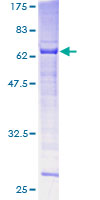 SPO11 Protein - 12.5% SDS-PAGE of human SPO11 stained with Coomassie Blue