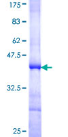 SPO11 Protein - 12.5% SDS-PAGE Stained with Coomassie Blue.