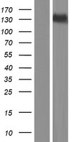 SPOCD1 Protein - Western validation with an anti-DDK antibody * L: Control HEK293 lysate R: Over-expression lysate