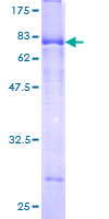 SPOCK2 Protein - 12.5% SDS-PAGE of human SPOCK2 stained with Coomassie Blue