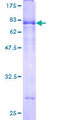 SPOCK2 Protein - 12.5% SDS-PAGE of human SPOCK2 stained with Coomassie Blue