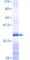 SPOCK3 Protein - 12.5% SDS-PAGE Stained with Coomassie Blue.