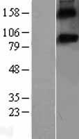 SPON1 / F-Spondin Protein - Western validation with an anti-DDK antibody * L: Control HEK293 lysate R: Over-expression lysate