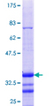 SPOP Protein - 12.5% SDS-PAGE Stained with Coomassie Blue.