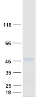 SPOP Protein - Purified recombinant protein SPOP was analyzed by SDS-PAGE gel and Coomassie Blue Staining