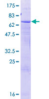 SPOPL Protein - 12.5% SDS-PAGE of human SPOPL stained with Coomassie Blue
