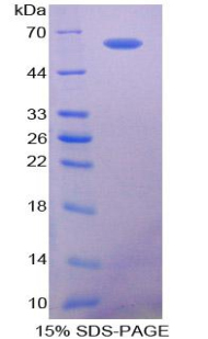 SPP1 / Osteopontin Protein - Recombinant Osteopontin By SDS-PAGE