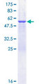 SPR Protein - 12.5% SDS-PAGE of human SPR stained with Coomassie Blue