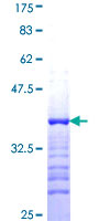 SPR Protein - 12.5% SDS-PAGE Stained with Coomassie Blue.