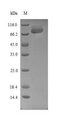 SPRED1 Protein - (Tris-Glycine gel) Discontinuous SDS-PAGE (reduced) with 5% enrichment gel and 15% separation gel.