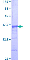 SPRED2 Protein - 12.5% SDS-PAGE Stained with Coomassie Blue.