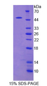 SPRED2 Protein - Recombinant Sprouty Related, EVH1 Domain Containing Protein 2 By SDS-PAGE