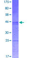 SPRING / TRIM9 Protein - 12.5% SDS-PAGE Stained with Coomassie Blue.