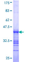 Sprouty 4 / SPRY4 Protein - 12.5% SDS-PAGE Stained with Coomassie Blue.